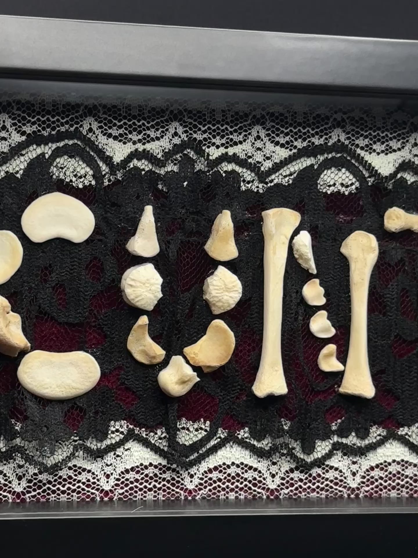Victorian Bone Display